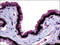 Melatonin Receptor 1B antibody, AP07079PU-N, Origene, Immunohistochemistry paraffin image 