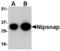 Protein NipSnap homolog 1 antibody, LS-C53279, Lifespan Biosciences, Western Blot image 