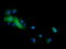 Cancer/Testis Antigen 1B antibody, LS-C174615, Lifespan Biosciences, Immunofluorescence image 