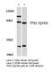 TPX2 Microtubule Nucleation Factor antibody, GTX66708, GeneTex, Western Blot image 