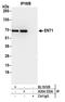 Equilibrative nucleoside transporter 1 antibody, A304-333A, Bethyl Labs, Immunoprecipitation image 