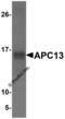 Anaphase Promoting Complex Subunit 13 antibody, 5739, ProSci, Western Blot image 