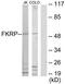 Fukutin Related Protein antibody, TA315775, Origene, Western Blot image 