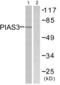Protein Inhibitor Of Activated STAT 3 antibody, abx013225, Abbexa, Western Blot image 
