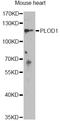 Procollagen-lysine,2-oxoglutarate 5-dioxygenase 1 antibody, LS-C749058, Lifespan Biosciences, Western Blot image 