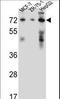 Hydroxysteroid 17-Beta Dehydrogenase 4 antibody, LS-C165036, Lifespan Biosciences, Western Blot image 