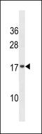 Vesicle Associated Membrane Protein 4 antibody, 60-942, ProSci, Western Blot image 
