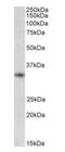 CD74 Molecule antibody, orb195359, Biorbyt, Western Blot image 