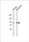 Poly(ADP-Ribose) Polymerase Family Member 9 antibody, PA5-48254, Invitrogen Antibodies, Western Blot image 