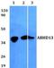 Abhydrolase Domain Containing 13 antibody, A16332, Boster Biological Technology, Western Blot image 