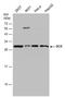 Deoxycytidine kinase antibody, MA5-27740, Invitrogen Antibodies, Western Blot image 