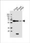 Phosphoglucomutase-1 antibody, PA5-72254, Invitrogen Antibodies, Western Blot image 
