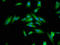 Cytoskeleton Associated Protein 5 antibody, LS-C671780, Lifespan Biosciences, Immunofluorescence image 