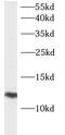 Late Endosomal/Lysosomal Adaptor, MAPK And MTOR Activator 5 antibody, FNab03778, FineTest, Western Blot image 