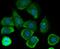 C-Type Lectin Domain Family 3 Member B antibody, NBP2-75442, Novus Biologicals, Immunocytochemistry image 