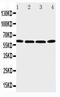 P2X purinoceptor 6 antibody, PA2128, Boster Biological Technology, Western Blot image 