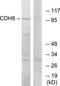 Cadherin 8 antibody, TA311920, Origene, Western Blot image 