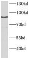 BRCA1 Associated Protein 1 antibody, FNab00800, FineTest, Western Blot image 