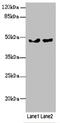 Zinc finger and BTB domain-containing protein 25 antibody, orb40628, Biorbyt, Western Blot image 