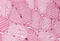 Acyl-CoA Dehydrogenase Medium Chain antibody, MBS241600, MyBioSource, Immunohistochemistry frozen image 