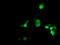 U6 snRNA-associated Sm-like protein LSm1 antibody, MA5-25593, Invitrogen Antibodies, Immunocytochemistry image 