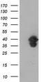 Vasodilator Stimulated Phosphoprotein antibody, TA502472, Origene, Western Blot image 