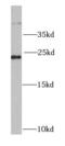 Ras-related protein Ral-B antibody, FNab07094, FineTest, Western Blot image 