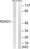 Radical S-Adenosyl Methionine Domain Containing 1 antibody, abx014776, Abbexa, Western Blot image 