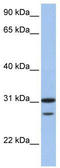 Ubiquitin-conjugating enzyme E2 C antibody, TA329810, Origene, Western Blot image 