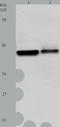 ADRB2 antibody, TA323758, Origene, Western Blot image 
