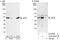 Eukaryotic Translation Initiation Factor 3 Subunit F antibody, A303-005A, Bethyl Labs, Immunoprecipitation image 
