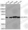 DNA Cross-Link Repair 1C antibody, A5615, ABclonal Technology, Western Blot image 