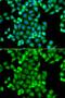 P21 (RAC1) Activated Kinase 2 antibody, GTX65807, GeneTex, Immunofluorescence image 