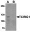 T Cell Immune Regulator 1, ATPase H+ Transporting V0 Subunit A3 antibody, orb75824, Biorbyt, Western Blot image 