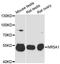Nuclear Receptor Subfamily 5 Group A Member 1 antibody, A1657, ABclonal Technology, Western Blot image 