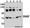 Decapping MRNA 1A antibody, A04587S133, Boster Biological Technology, Western Blot image 