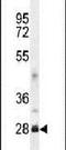 DnaJ Heat Shock Protein Family (Hsp40) Member B8 antibody, PA5-24140, Invitrogen Antibodies, Western Blot image 
