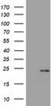 Visinin Like 1 antibody, TA801948BM, Origene, Western Blot image 