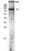 Complement C7 antibody, A00844, Boster Biological Technology, Western Blot image 