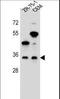 Neuronal membrane glycoprotein M6-b antibody, LS-C166615, Lifespan Biosciences, Western Blot image 