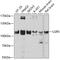 Leucine Rich Repeat Containing G Protein-Coupled Receptor 5 antibody, 13-711, ProSci, Western Blot image 