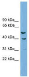 RNA Binding Fox-1 Homolog 1 antibody, TA343882, Origene, Western Blot image 
