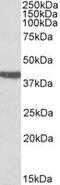 Troponin T2, Cardiac Type antibody, MBS423139, MyBioSource, Western Blot image 