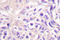 Ubiquitin-like modifier-activating enzyme 7 antibody, LS-C176363, Lifespan Biosciences, Immunohistochemistry paraffin image 