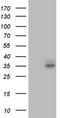 FR-beta antibody, NBP2-45693, Novus Biologicals, Western Blot image 