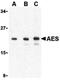 Amino-terminal enhancer of split antibody, PA5-20169, Invitrogen Antibodies, Western Blot image 
