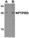 Protein Tyrosine Phosphatase Receptor Type D antibody, orb75801, Biorbyt, Western Blot image 