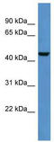 Deltex E3 Ubiquitin Ligase 3 antibody, TA331561, Origene, Western Blot image 