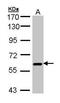UDP-N-Acetylglucosamine Pyrophosphorylase 1 antibody, PA5-21500, Invitrogen Antibodies, Western Blot image 