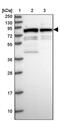 Lysine Acetyltransferase 7 antibody, PA5-60723, Invitrogen Antibodies, Western Blot image 